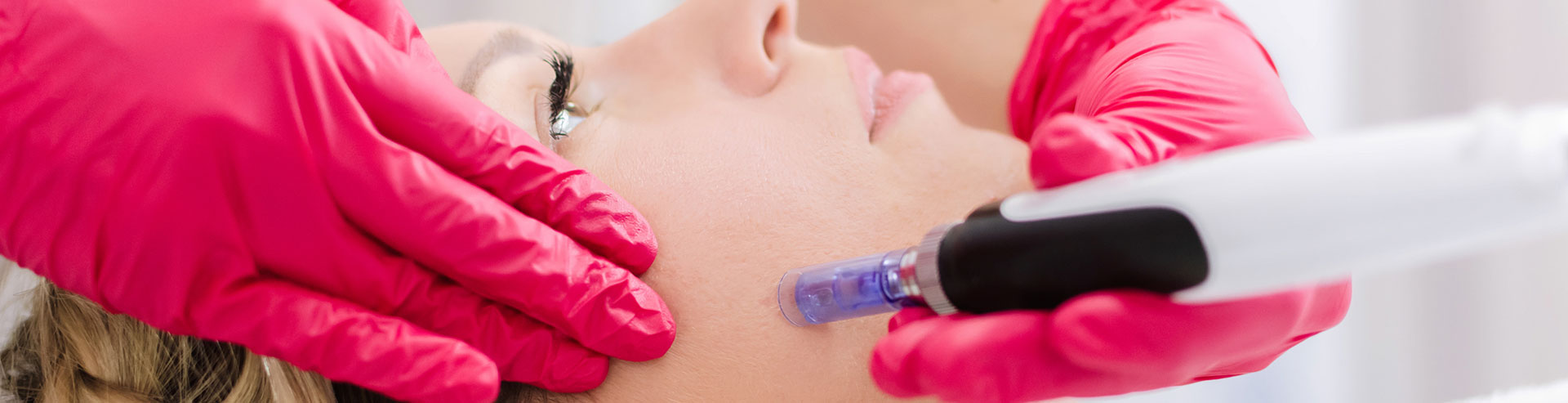 A woman is having collagen pin microneedling treatment